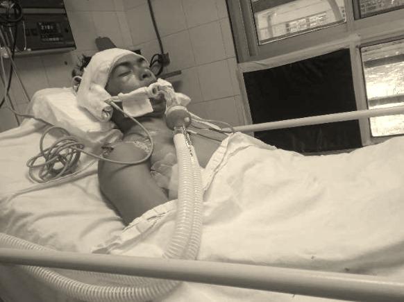 Alexis-Mendoza-internado-en-el-Perrando-por-salvaje-ataque