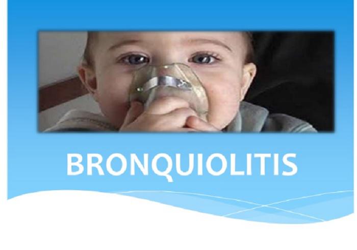 bronquiolitis