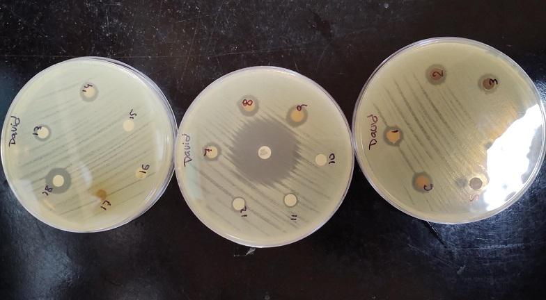 nanoparticulas-de-plata