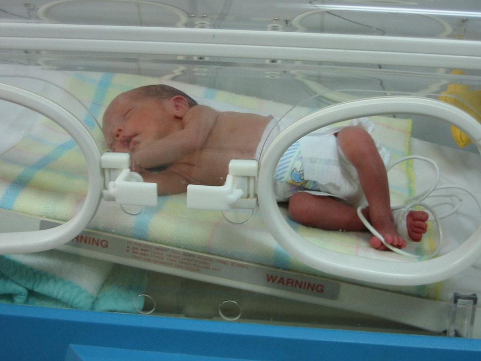 bebe-prematuro 2020-11-17
