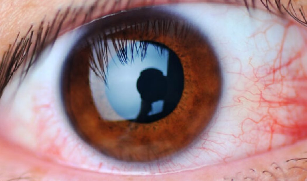 retinopatia-diabetica-argentina