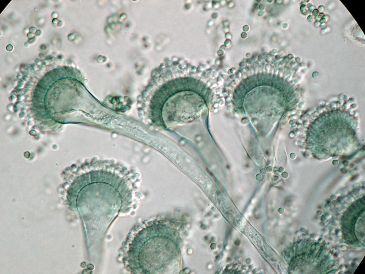 Aspergillus- fumigatus-01
